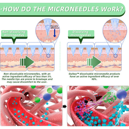 👩‍⚕️Oyikey™ SMGT-GLP-1 Nano Microneedle Patch（Painless, long-lasting, addressing diabetes, obesity, and cardiovascular diseases）
