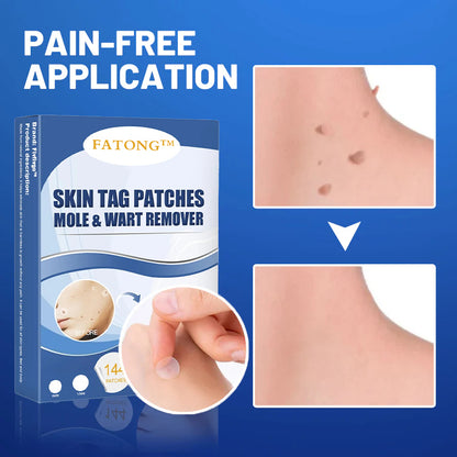 𝐹𝐴𝑇𝑂𝑁𝐺™ Moles & Warts Removing Skin Tag Patch