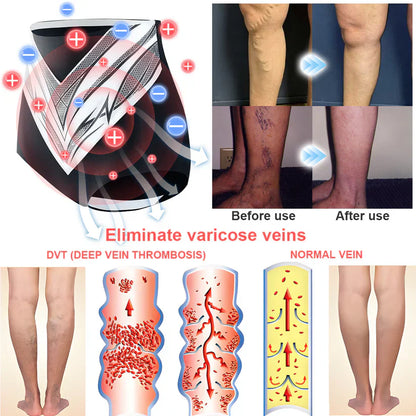 VOCJFEI™ Medical Grade Titanium Fiber Tourmaline Shaping Shorts (LAST DAY SALE-80% OFF)👙